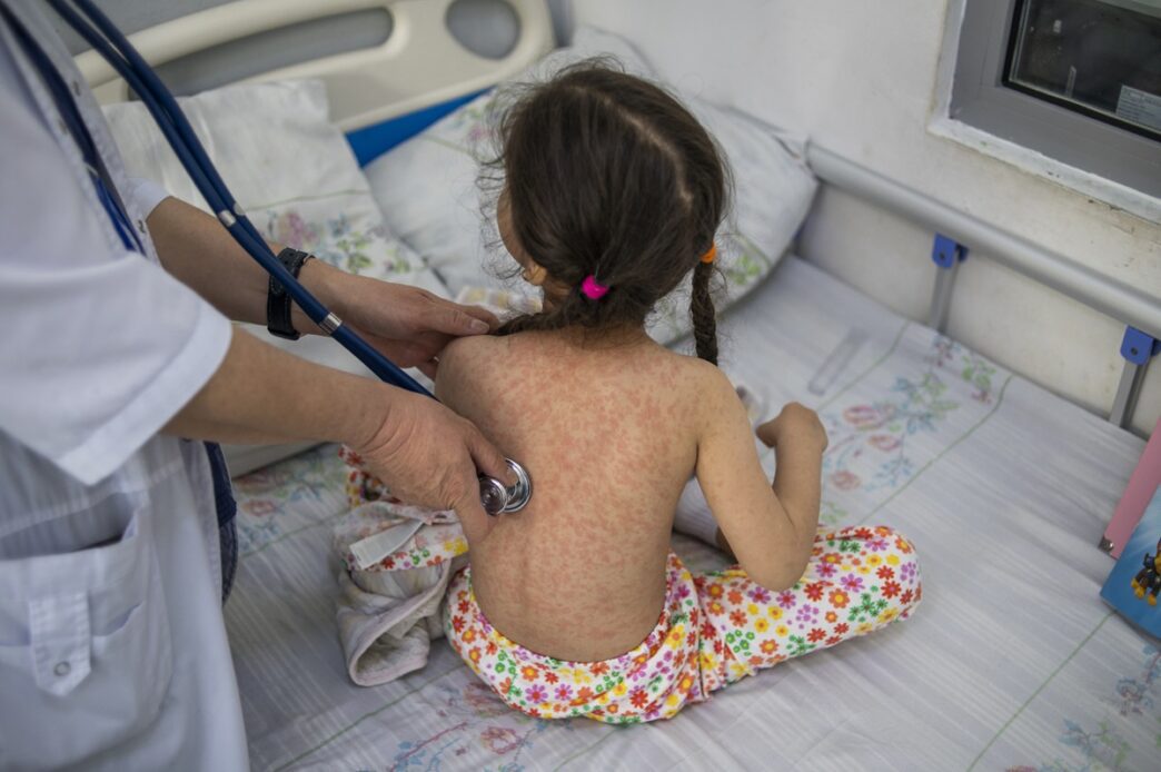 El Ministerio de Salud declaró una epidemia local de sarampión luego de confirmar más de 5,120 casos y cinco fallecimientos. (Foto: OMS / AUN)