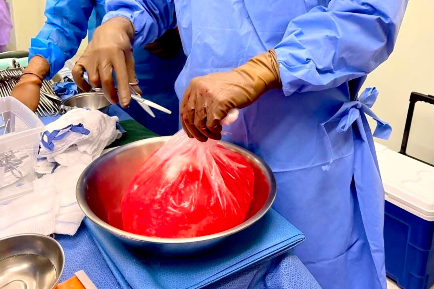 Conozca los requisitos para donar, el proceso para trasplante de riñones y córneas, y las severas penas de cárcel por tráfico de órganos en el país. (Foto: Fundación Daré / AUN)