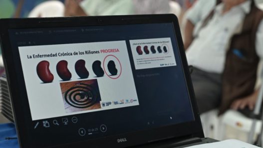 En Guatemala se detecta un caso de insuficiencia renal cada 45 minutos, siendo la diabetes mellitus e hipertensión las causas principales. (Foto: AGN / AUN)
