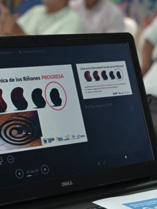En Guatemala se detecta un caso de insuficiencia renal cada 45 minutos, siendo la diabetes mellitus e hipertensión las causas principales. (Foto: AGN / AUN)
