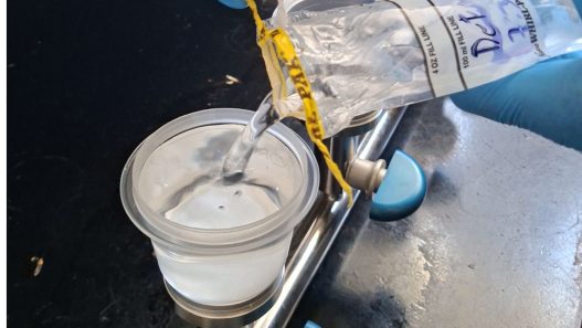La presencia de bacterias como Escherichia coli en los sistemas de abastecimiento de agua en Guatemala sigue siendo un gran reto de salud pública, provocando enfermedades gastrointestinales que afectan principalmente a poblaciones vulnerables. (Foto: Luis Juárez / AUN)