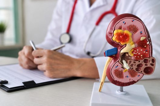 La salud renal requiere atención y prevención para reducir el riesgo de complicaciones. (Foto: IGSS / AUN)