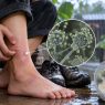 Las condiciones de humedad durante la temporada de lluvias pueden favorecer la proliferación de hongos y aumentar el riesgo de algunas infecciones. (Foto: GEMINI / AUN)
